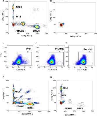 Peripheral blood marker of residual acute leukemia after hematopoietic cell transplantation using multi-plex digital droplet PCR